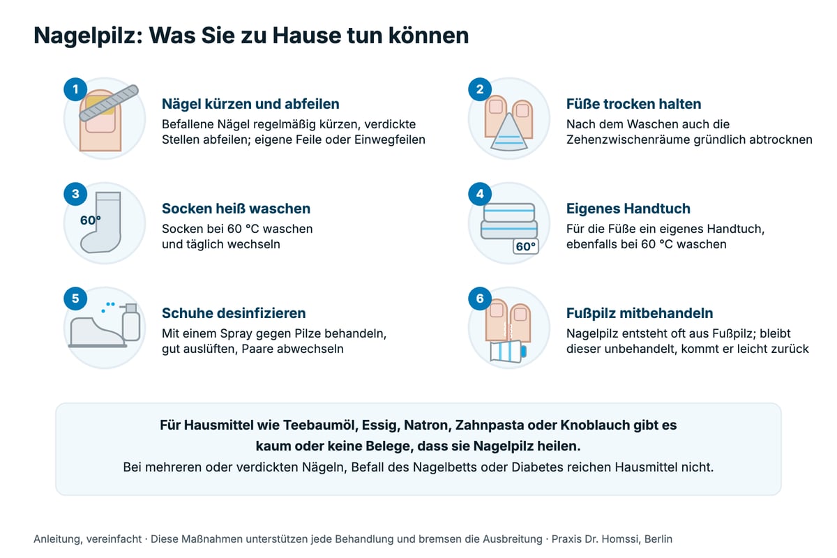 Anleitung: sechs Maßnahmen bei Nagelpilz zu Hause: Nägel kürzen und abfeilen, Füße trocken halten, Socken heiß waschen, eigenes Handtuch, Schuhe desinfizieren und Fußpilz mitbehandeln