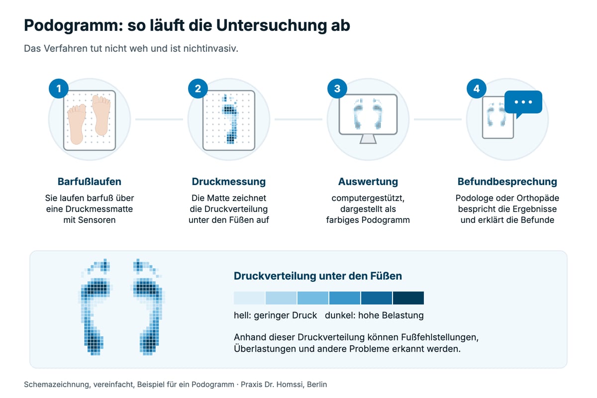 Anleitung: Ablauf eines Podogramms in vier Schritten, Barfußlaufen über die Druckmessmatte, Druckmessung, Auswertung und Befundbesprechung, dazu ein Beispiel-Podogramm mit Farbskala von hell bis dunkel