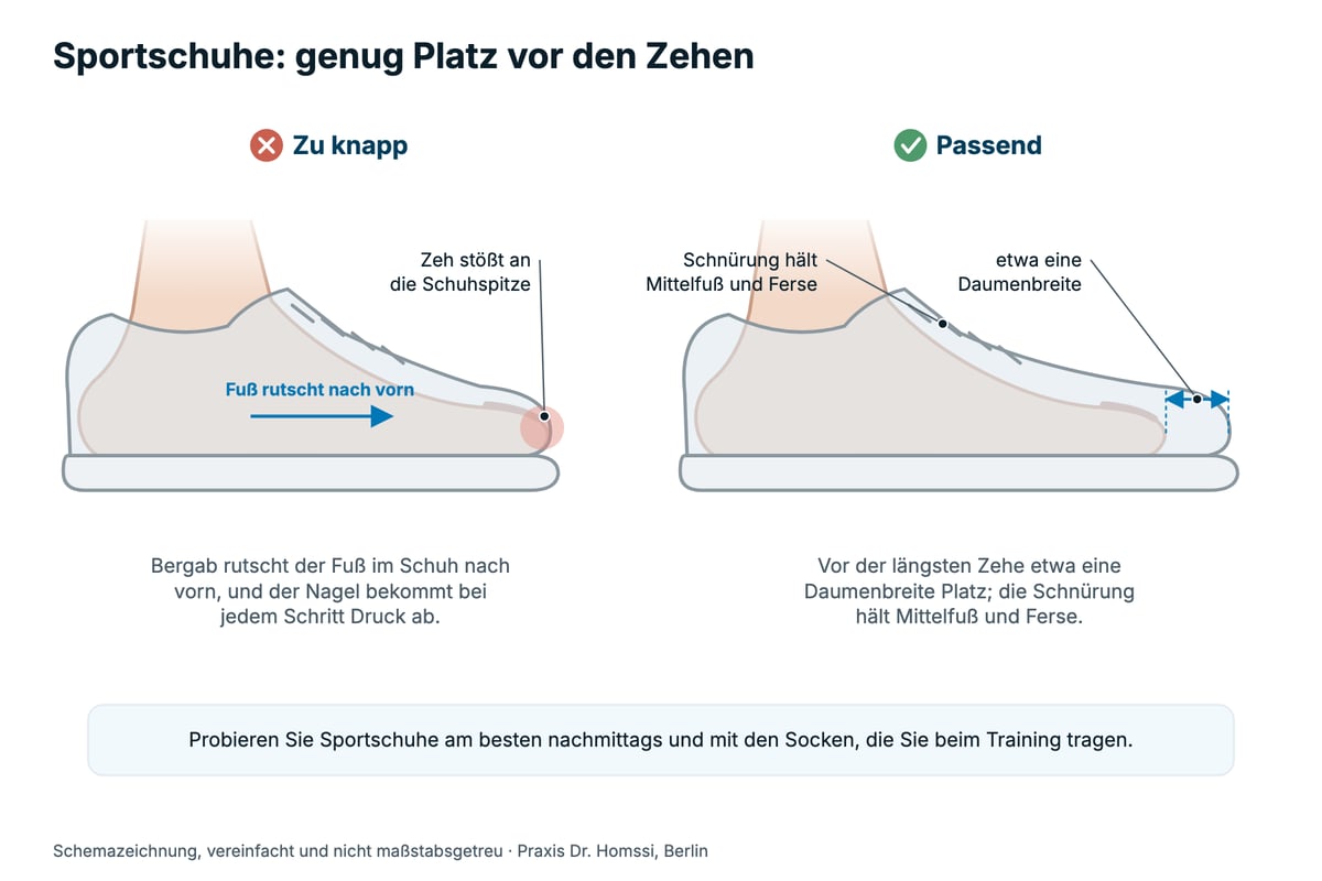 Schemazeichnung von der Seite: links ein zu knapper Sportschuh, in dem der Fuß nach vorn rutscht und der Zeh an die Schuhspitze stößt; rechts ein passender Schuh mit etwa einer Daumenbreite Platz vor der Zehe und einer Schnürung, die Mittelfuß und Ferse hält