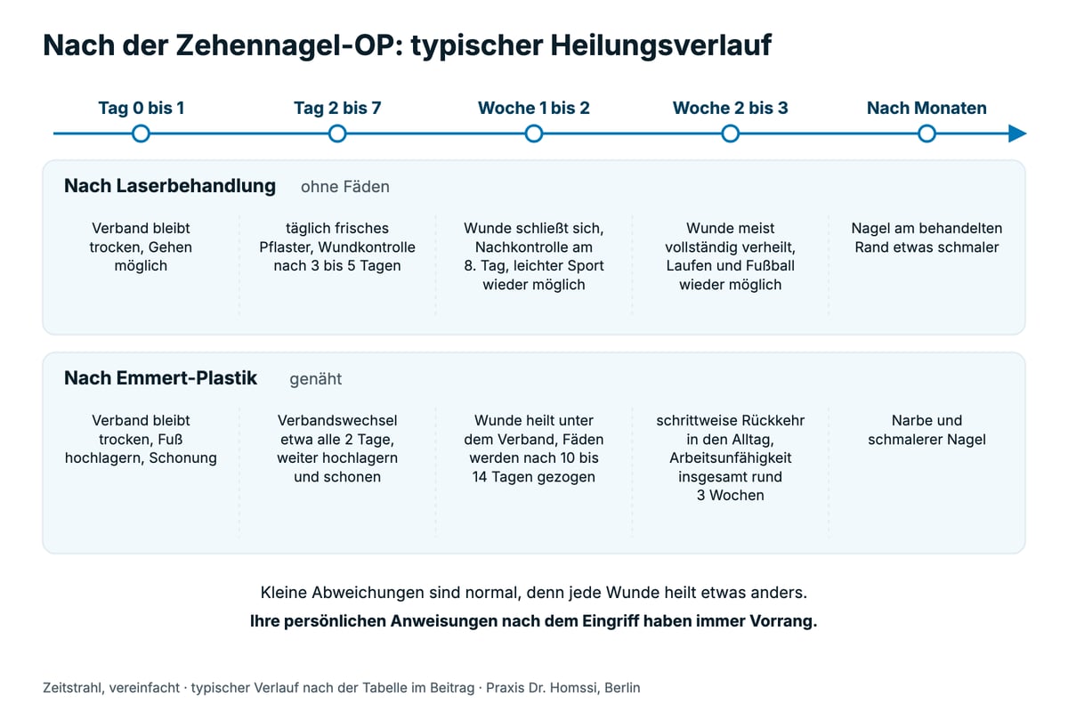 Zeitstrahl von Tag 0 bis nach Monaten: typischer Heilungsverlauf nach Laserbehandlung ohne Fäden und nach Emmert-Plastik mit Naht