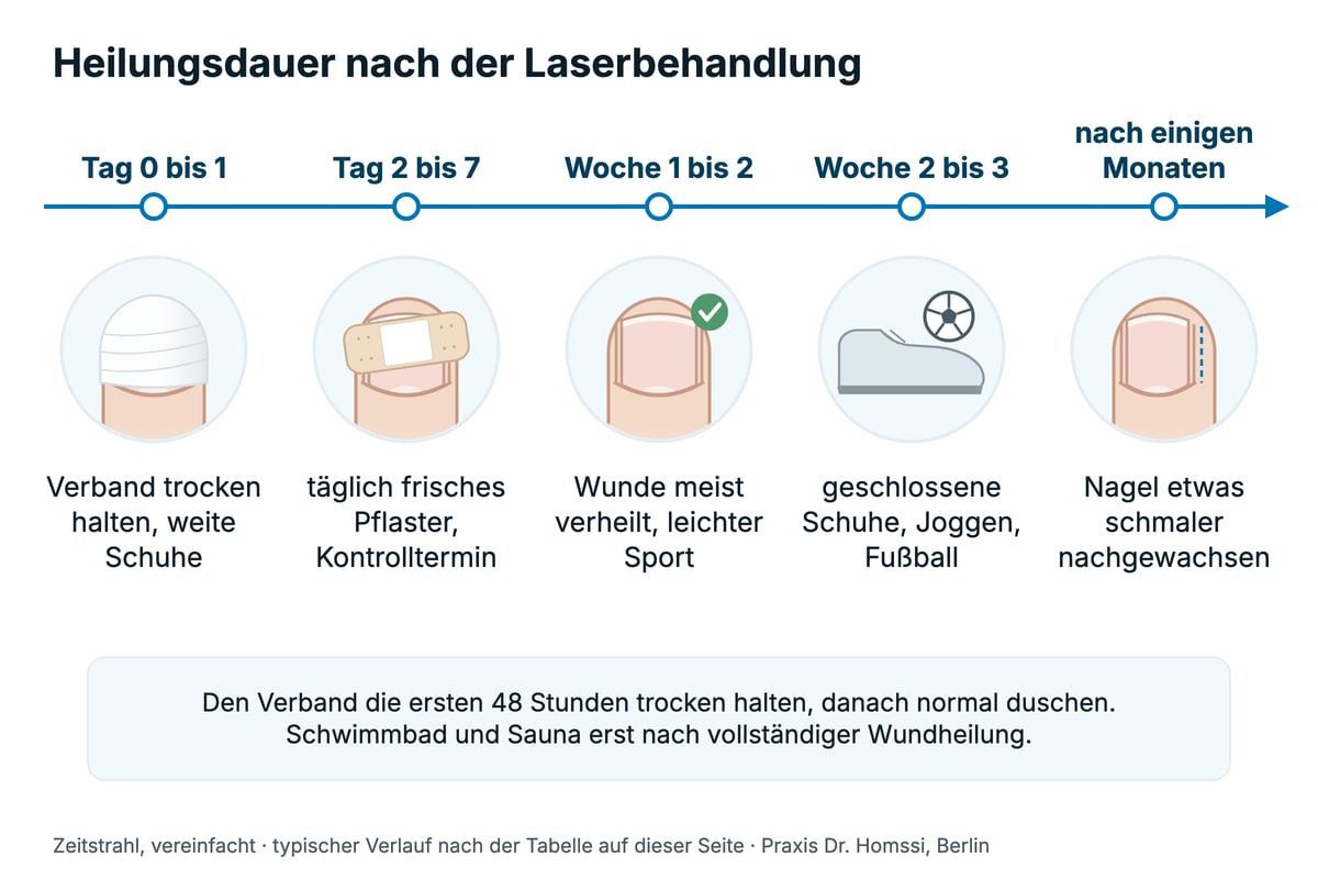 Zeitstrahl zur Heilungsdauer nach der Laserbehandlung eines eingewachsenen Zehennagels, vom Behandlungstag bis einige Monate danach.