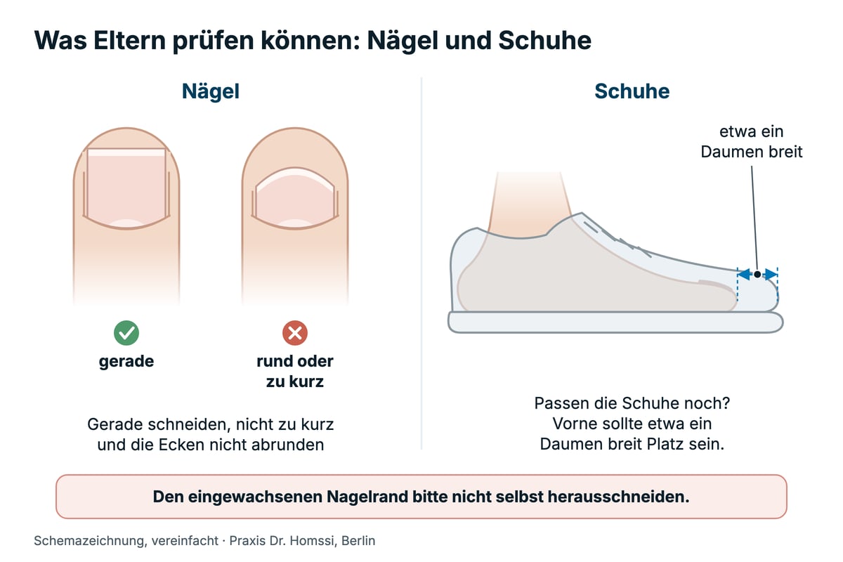 Schemazeichnung für Eltern zum eingewachsenen Zehennagel bei Kindern: gerade geschnittener Nagel und Schuh mit etwa einem Daumen breit Platz vor den Zehen.