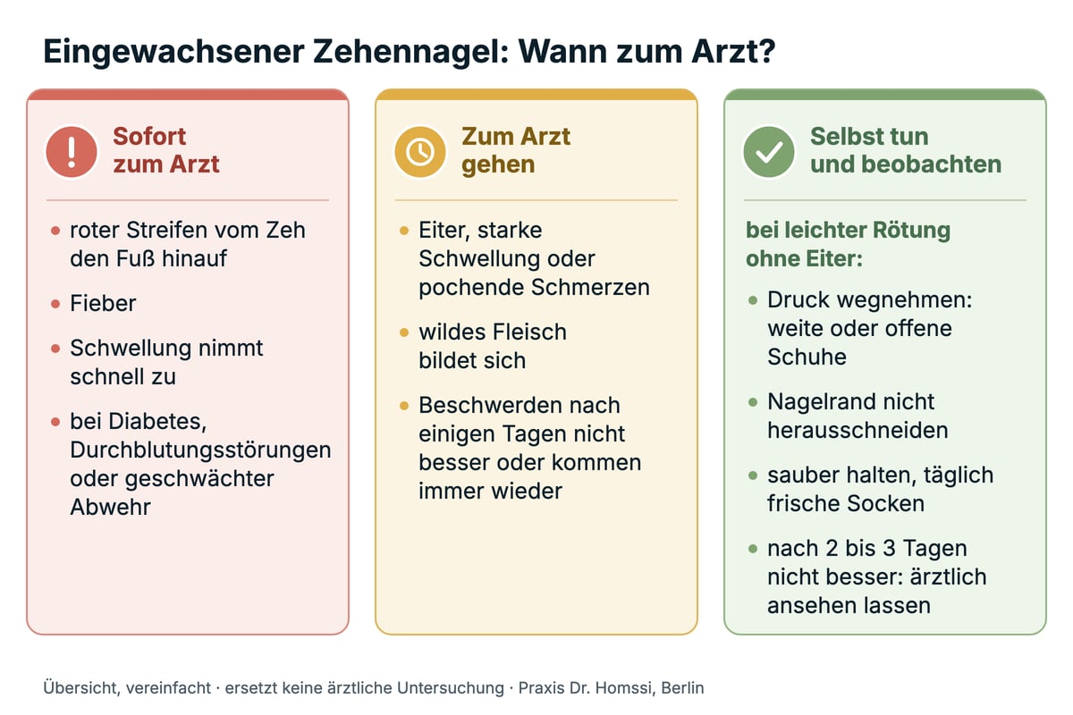 Übersicht eingewachsener Zehennagel: wann Sie sofort zum Arzt gehen, wann zum Arzt und was Sie bei leichter Rötung ohne Eiter selbst tun können.