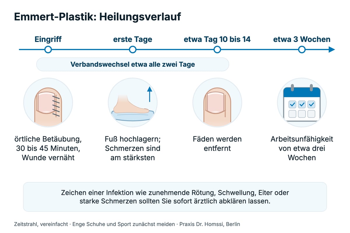 Zeitstrahl zum Heilungsverlauf nach der Emmert-Plastik: Eingriff, erste Tage, Fäden entfernen und Arbeitsunfähigkeit.