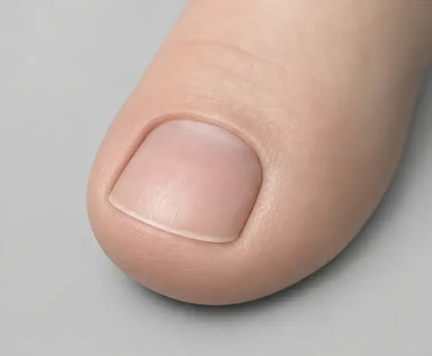 Healthy toenail after successful treatment, illustration