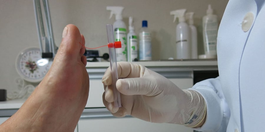 Medizinische Fußpflege: behandschuhte Hand hält ein Probenröhrchen an den großen Zeh, im Hintergrund Sprühflaschen